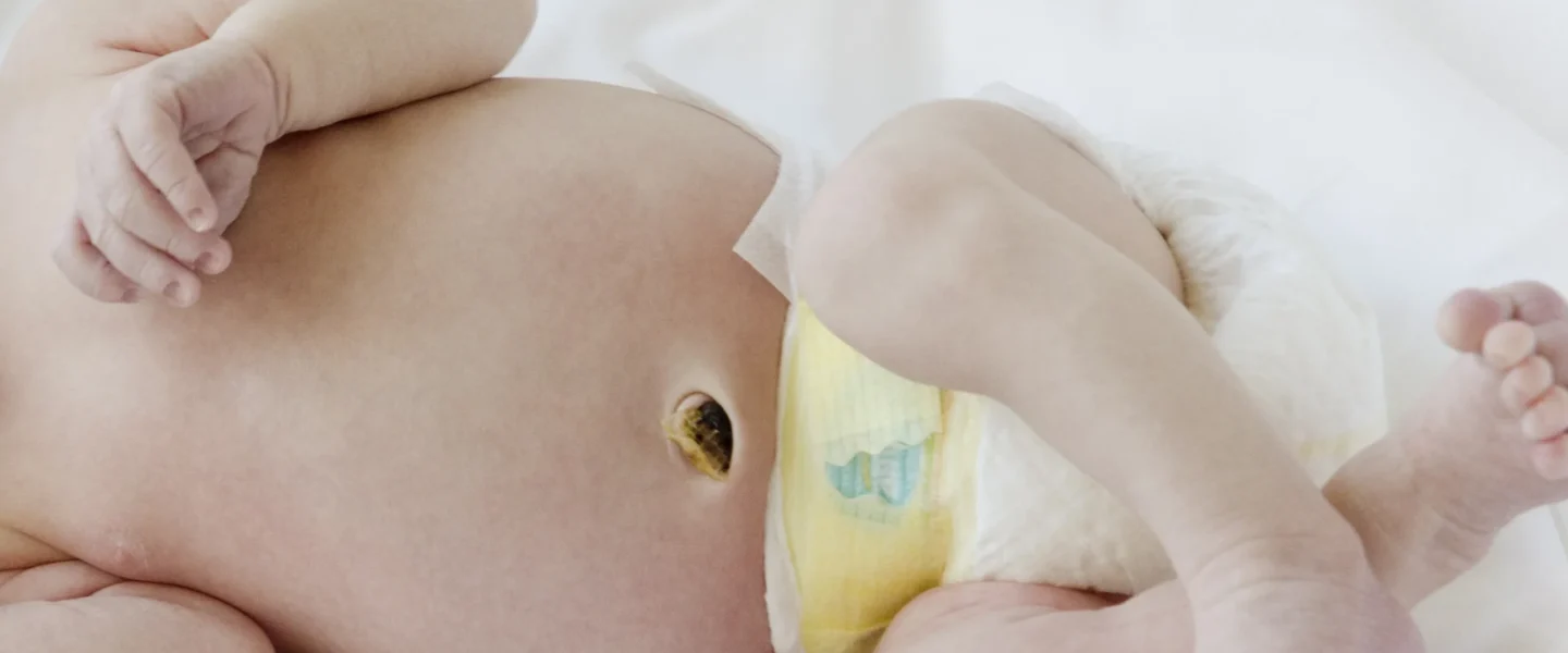 Close-up of a newborn's abdomen showing the healing umbilical cord stump above the diaper