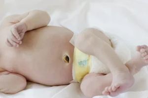 Close-up of a newborn's abdomen showing the healing umbilical cord stump above the diaper