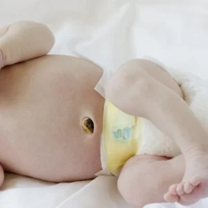 Close-up of a newborn's abdomen showing the healing umbilical cord stump above the diaper