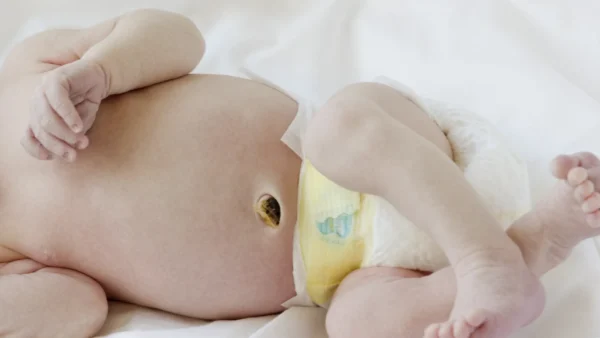 Close-up of a newborn's abdomen showing the healing umbilical cord stump above the diaper